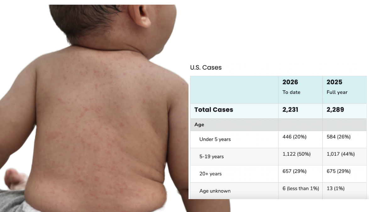 Measles Makes A Comeback In The US Amid Falling Vaccination Rates